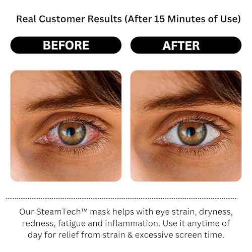 Self-Heating Steam Eye Mask for Dry Eyes, Soothing Relief, Stress Reduction
| Disposable Warm Eye Compress for Dry Eyes